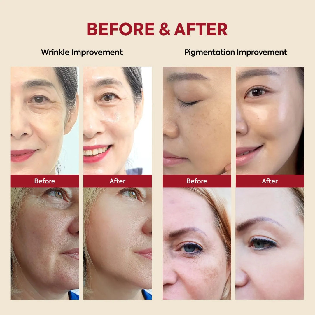 KSECRET – SEOUL 1988  Sérum Anti-âge au Rétinol Serum : Retinal Liposome 2% + Black Ginseng
