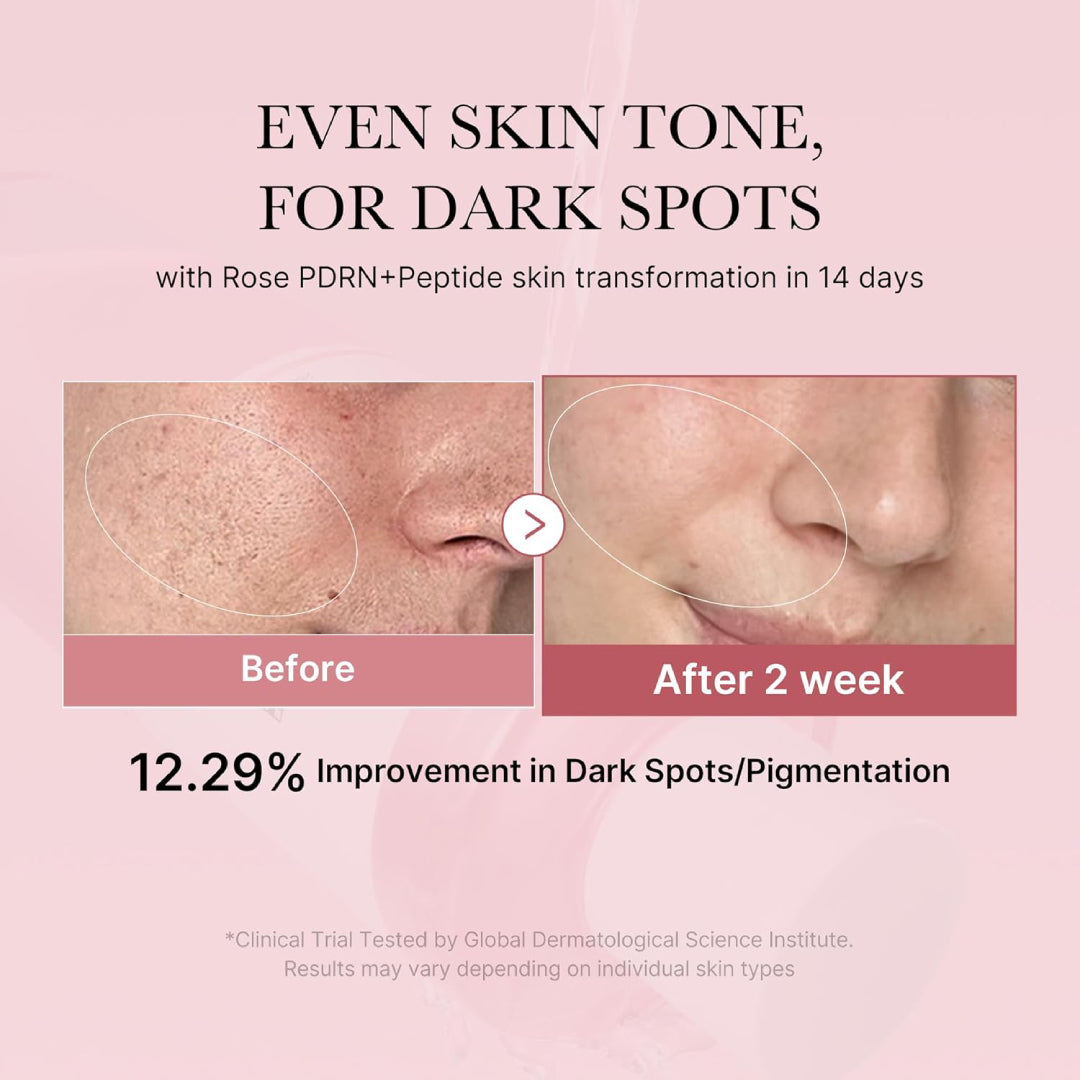 MEDICUBE - PDRN Pink Niacinamide Milky Toner for Hydrating - 250 ml