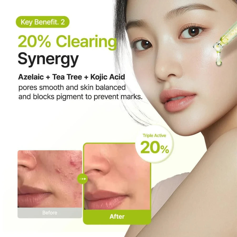 Purito SEOUL Azelaic Acid 10 Kojic Tea Tree Serum - 30ml