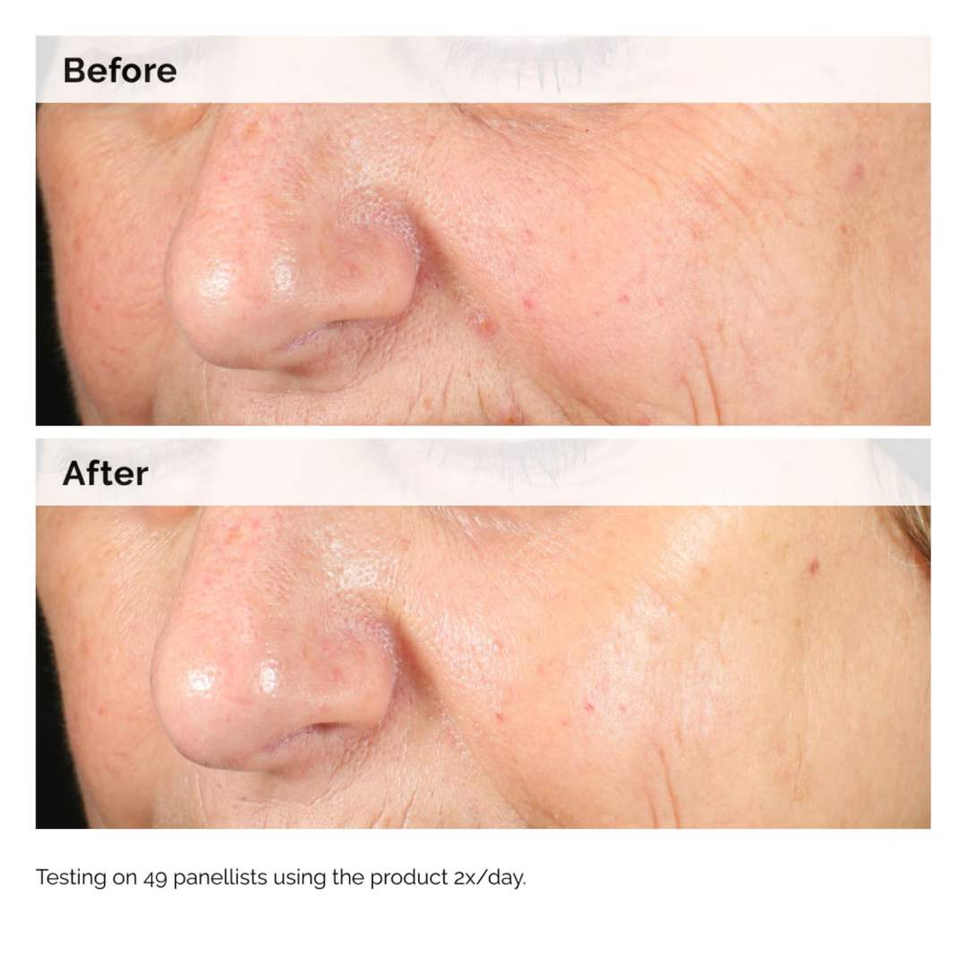 THE ORDINARY - Alpha Arbutin 2% + HA - 30ml