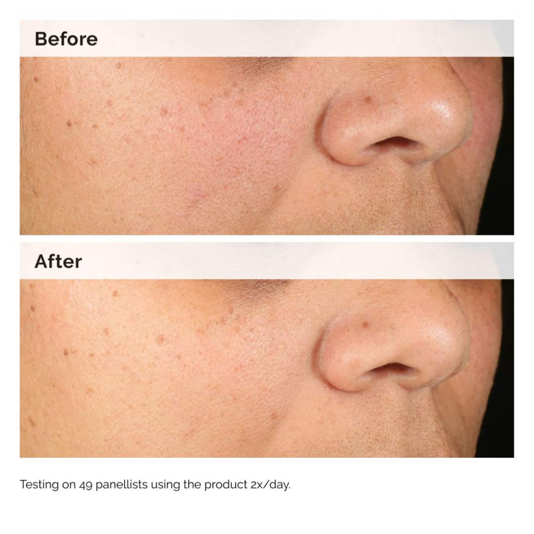 THE ORDINARY - Alpha Arbutin 2% + HA - 30ml