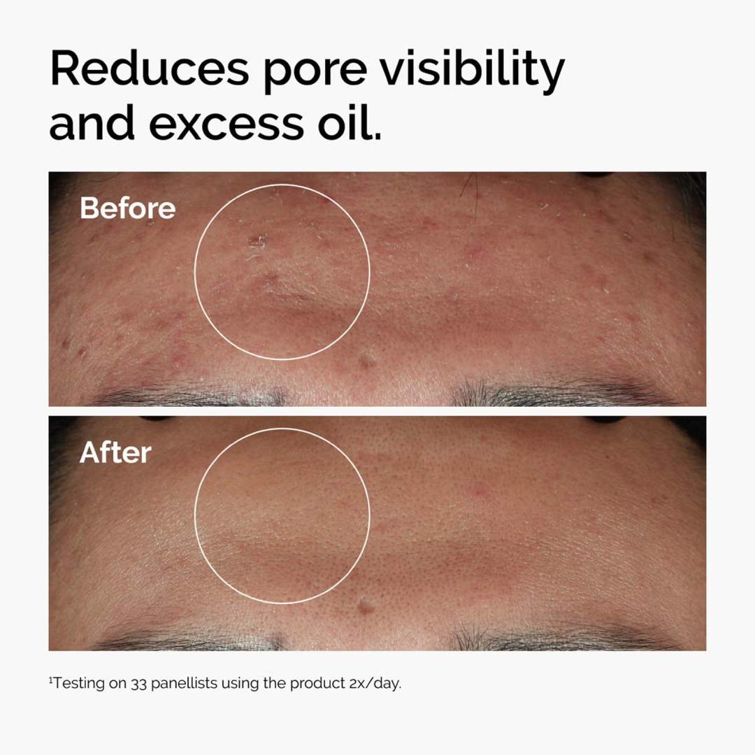 THE ORDINARY - Niacinamide 10% + Zinc 1% Oil Control Serum - 30ml