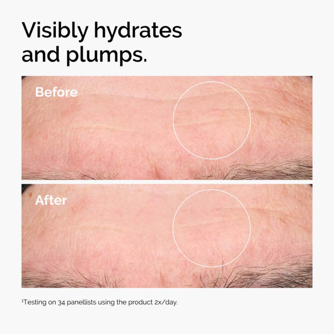 THE ORDINARY - hyaluronic acid 2% + B5 - 30ml