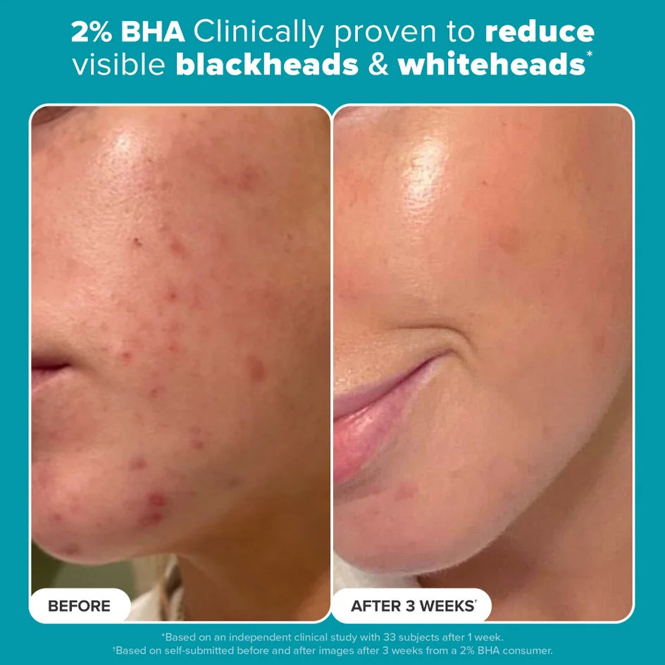 PAULA'S CHOICE - Le Kit Exfoliants AHA + BHA