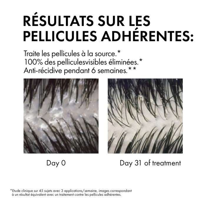 VICHY VICHY DERCOS SHAMPOING ANTI-PELLICULAIRE CHEVEUX SECS - 200ML